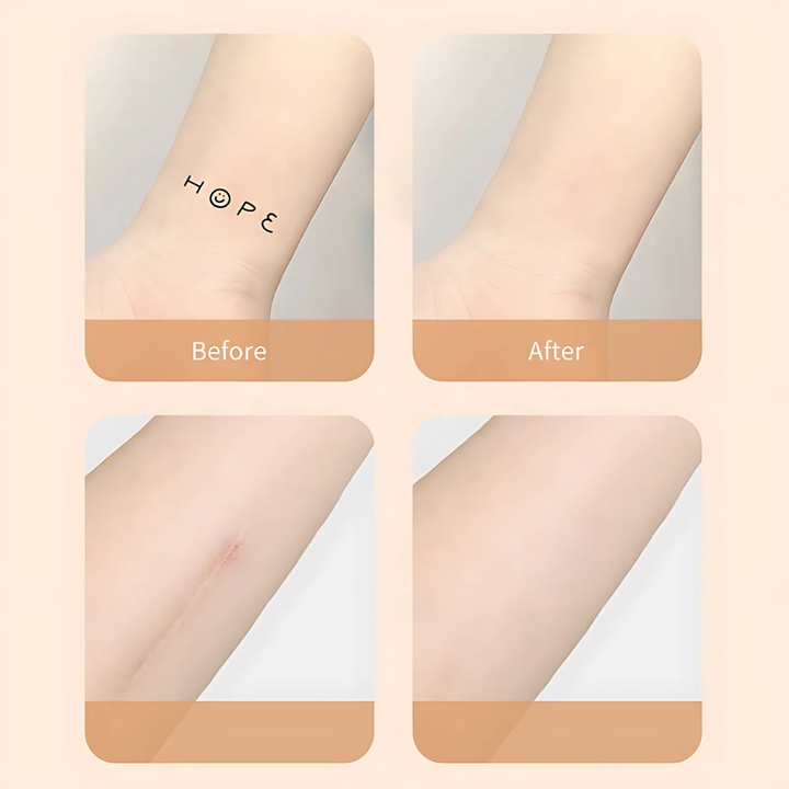 Parche corrector de belleza para cicatrices. Cobertura de piel impermeable, discreto y autoadhesivo.