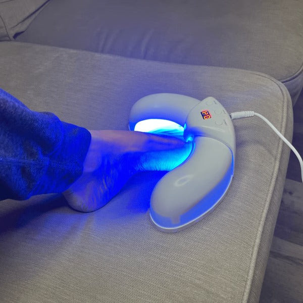 Dispositivo láser portátil para eliminar hongos en uñas de pies y manos, tratamiento antimicótico.