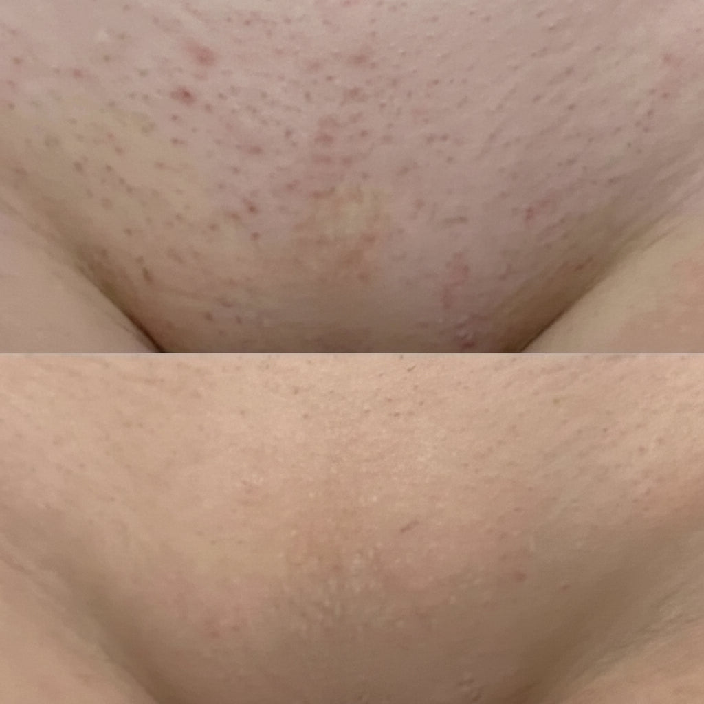 Dispositivo de depilación femenina, resistente al agua, afeitado cómodo y rápido para piel delicada, kit de belleza.