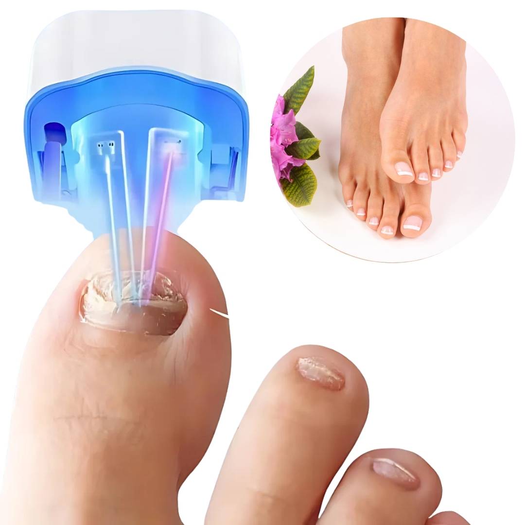 Tratamiento láser innovador para hongos de uñas. Dispositivo portátil para belleza y salud de uñas en casa, sin dolor.