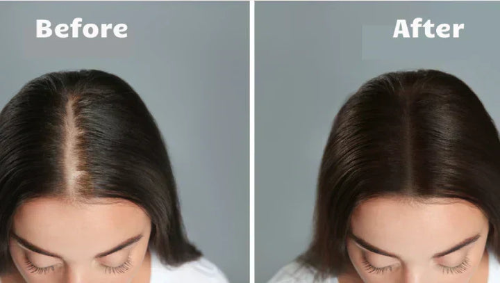 Estimulador capilar 4 en 1 con base de carga. Cuidado diario del cabello para volumen y anti-caída.