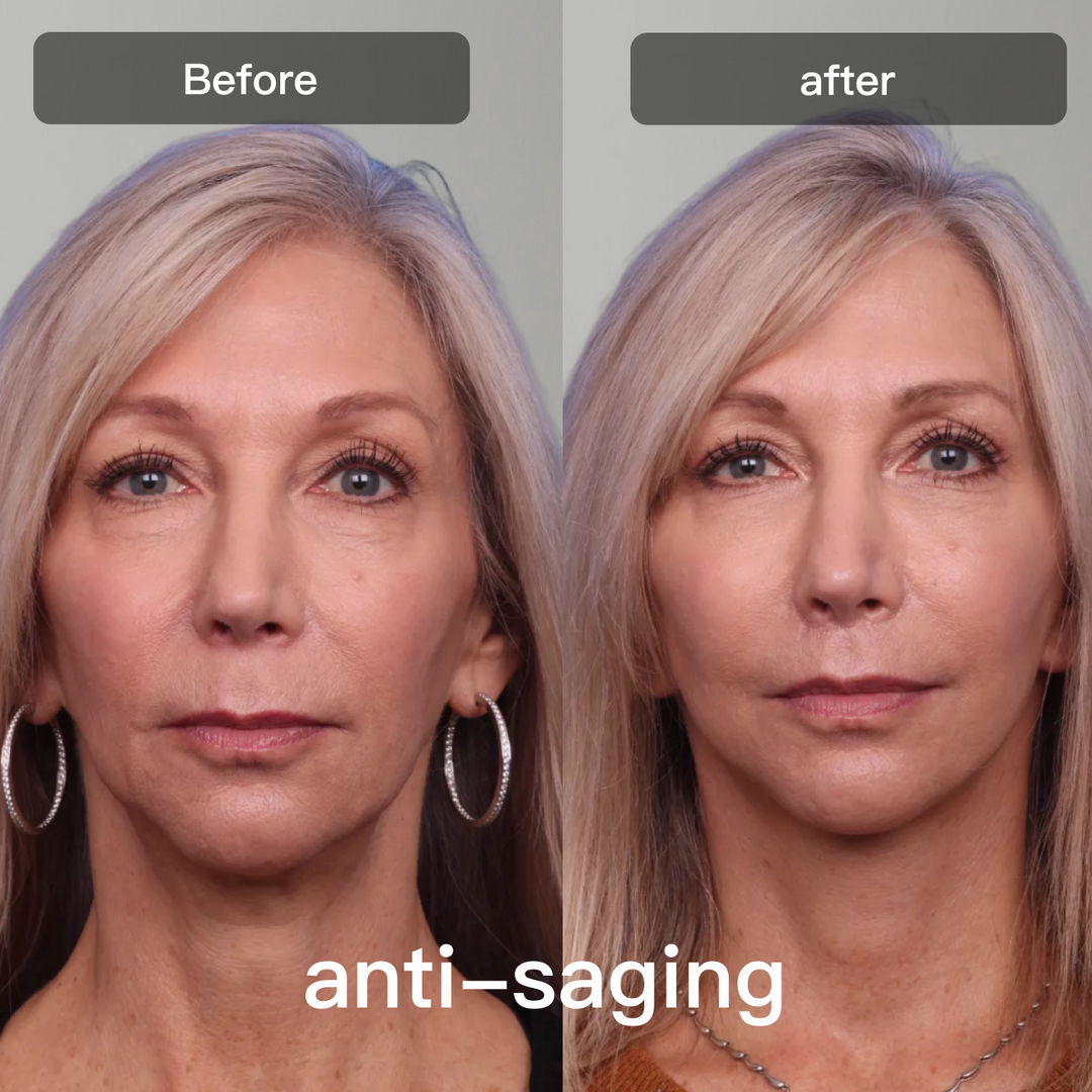 Tratamiento facial LED avanzado, 7 ondas para rejuvenecimiento, colágeno y piel sin imperfecciones.