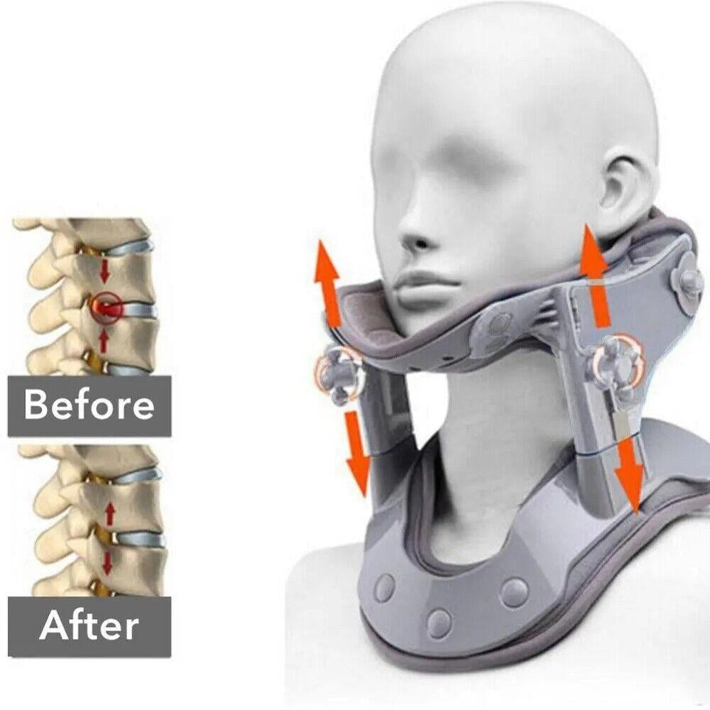 Recuperación cervical con dispositivo de tracción. Reduce el dolor de cuello y mejora movilidad.