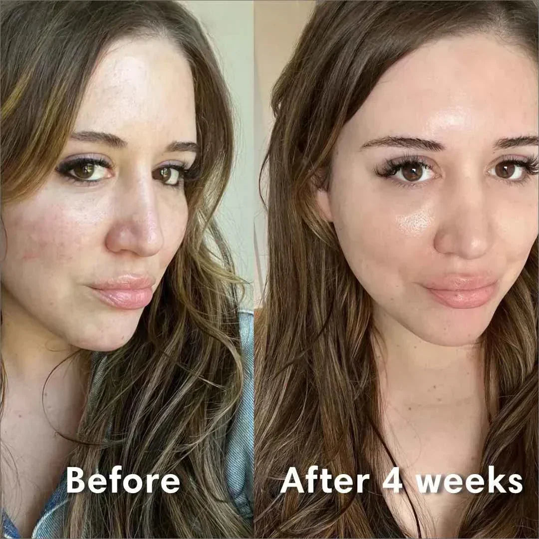 Mascarilla facial de colágeno que restaura la barrera cutánea. Piel hidratada y joven por la mañana.