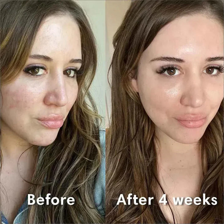 Mascarilla facial de colágeno que restaura la barrera cutánea. Piel hidratada y joven por la mañana.