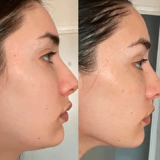 Primer plano del dispositivo facial multiuso, ideal para el cuidado de la piel y un lifting en casa.
