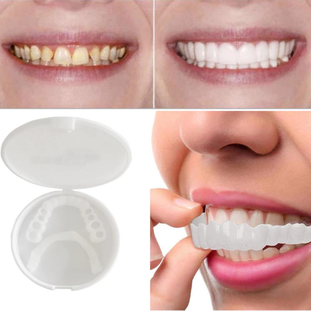 Mujer con sonrisa radiante y dientes blancos, resultado de la solución dental estética no invasiva.