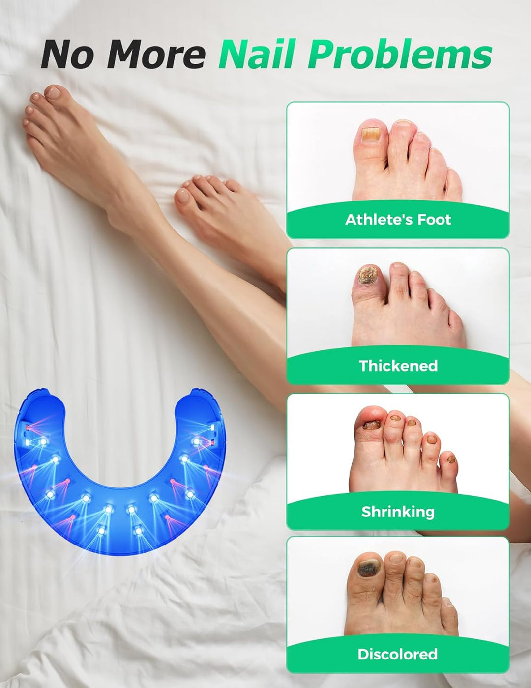 Tratamiento de uñas con dispositivo láser inalámbrico. Combate micosis y onicomicosis en manos y pies.