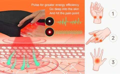 Par de guantes de terapia infrarroja para manos, promoviendo la fisioterapia y reducción del dolor.